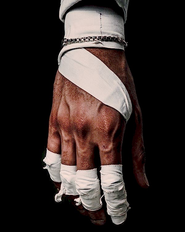 MMA